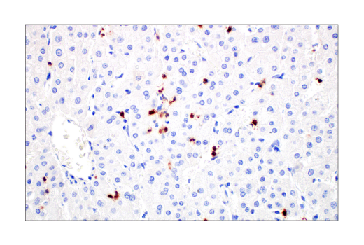 Immunohistochemistry Image 8: CD2 (D6V9F) Rabbit mAb (BSA and Azide Free)
