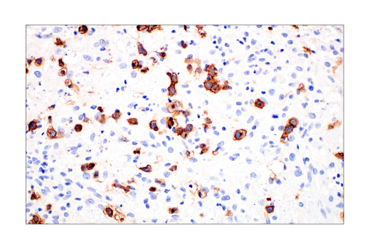 Immunohistochemistry Image 9: CD2 (D6V9F) Rabbit mAb (BSA and Azide Free)