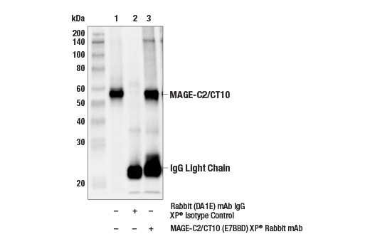 Immunoprecipitation Image 1: MAGE-C2/CT10 (E7B8D) XP® Rabbit mAb