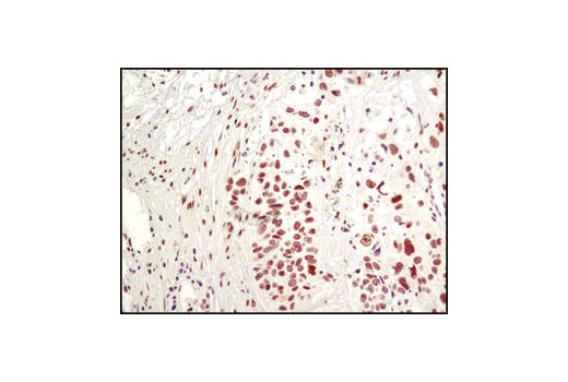 Immunohistochemistry Image 1: FoxP1 Antibody