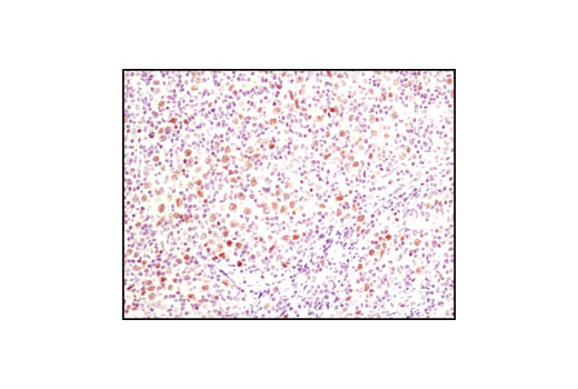Immunohistochemistry Image 2: FoxP1 Antibody