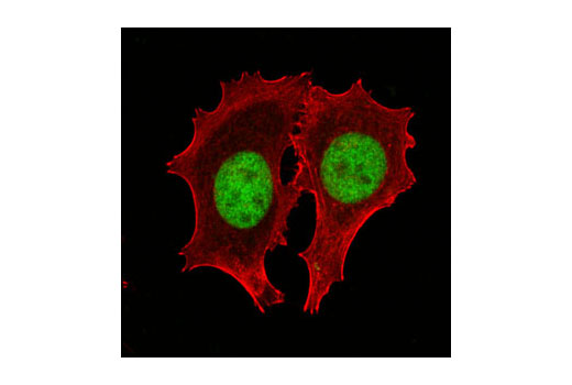 Immunofluorescence Image 1: FoxP1 Antibody
