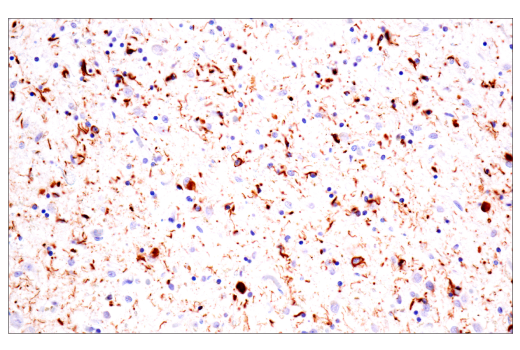 Immunohistochemistry Image 3: Phospho-Tau (Thr205) (E3E3B) Mouse mAb