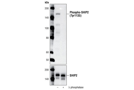 Western Blotting Image 1: Phospho-SHIP2 (Tyr1135) Antibody
