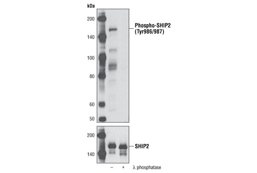Western Blotting Image 1: Phospho-SHIP2 (Tyr986/987) Antibody