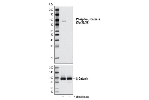 Western Blotting Image 1: Phospho-β-Catenin (Ser33/37) Antibody