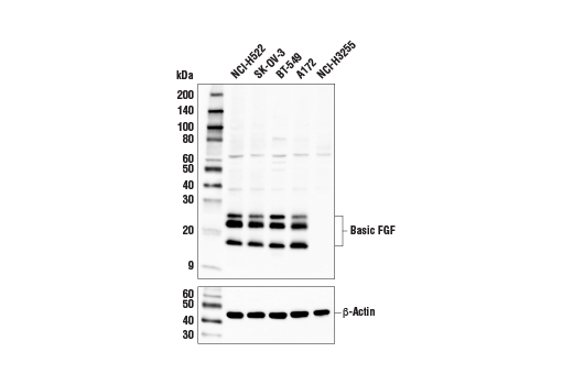 Western Blotting Image 1: Basic FGF Antibody