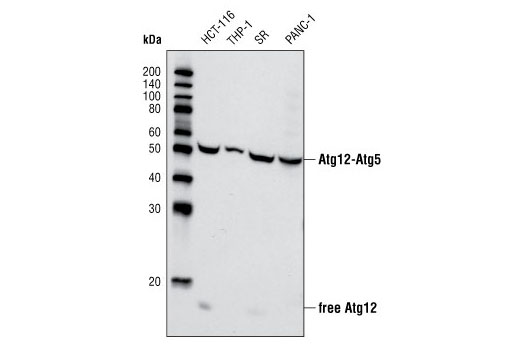  Image 2: Autophagosome Marker Antibody Sampler Kit