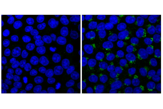 Immunofluorescence Image 1: NBR1 (E6Q3F) Rabbit mAb