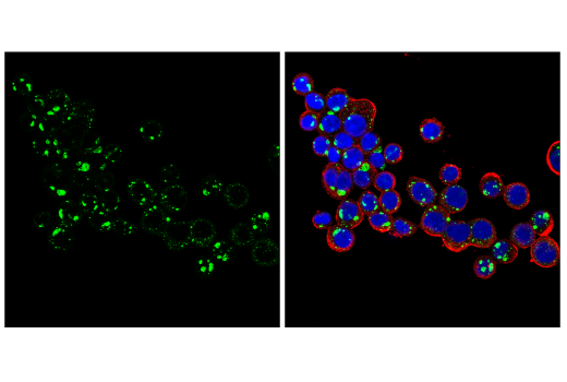 Immunofluorescence Image 2: NBR1 (E6Q3F) Rabbit mAb