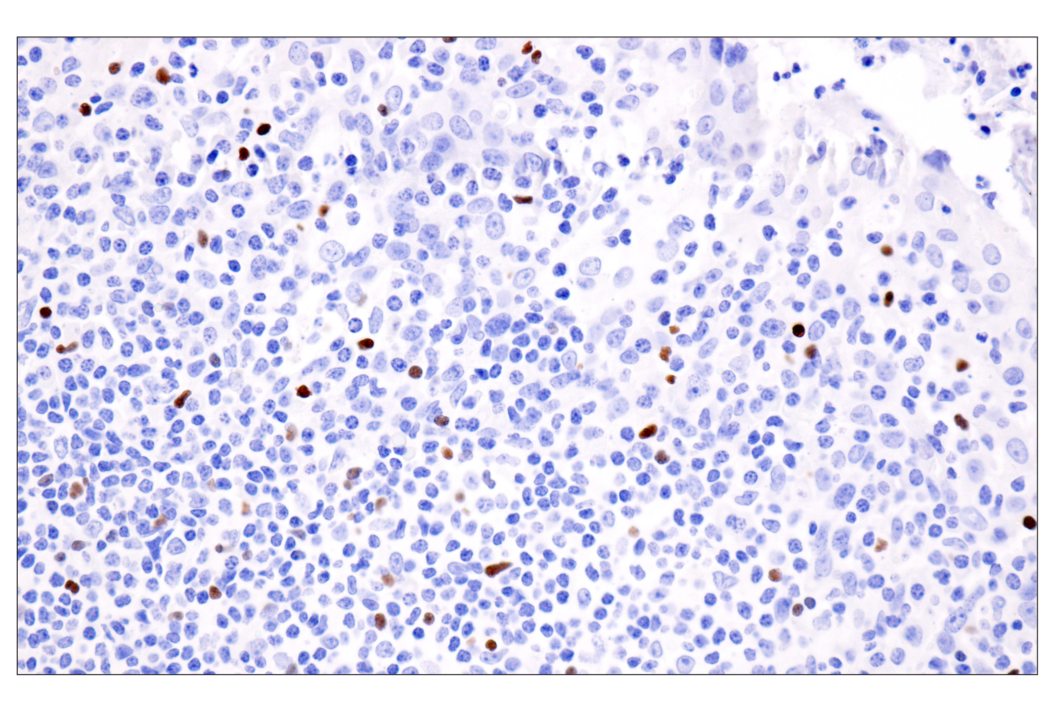 Immunohistochemistry Image 6: FoxP3 (221D) Mouse Monoclonal Antibody