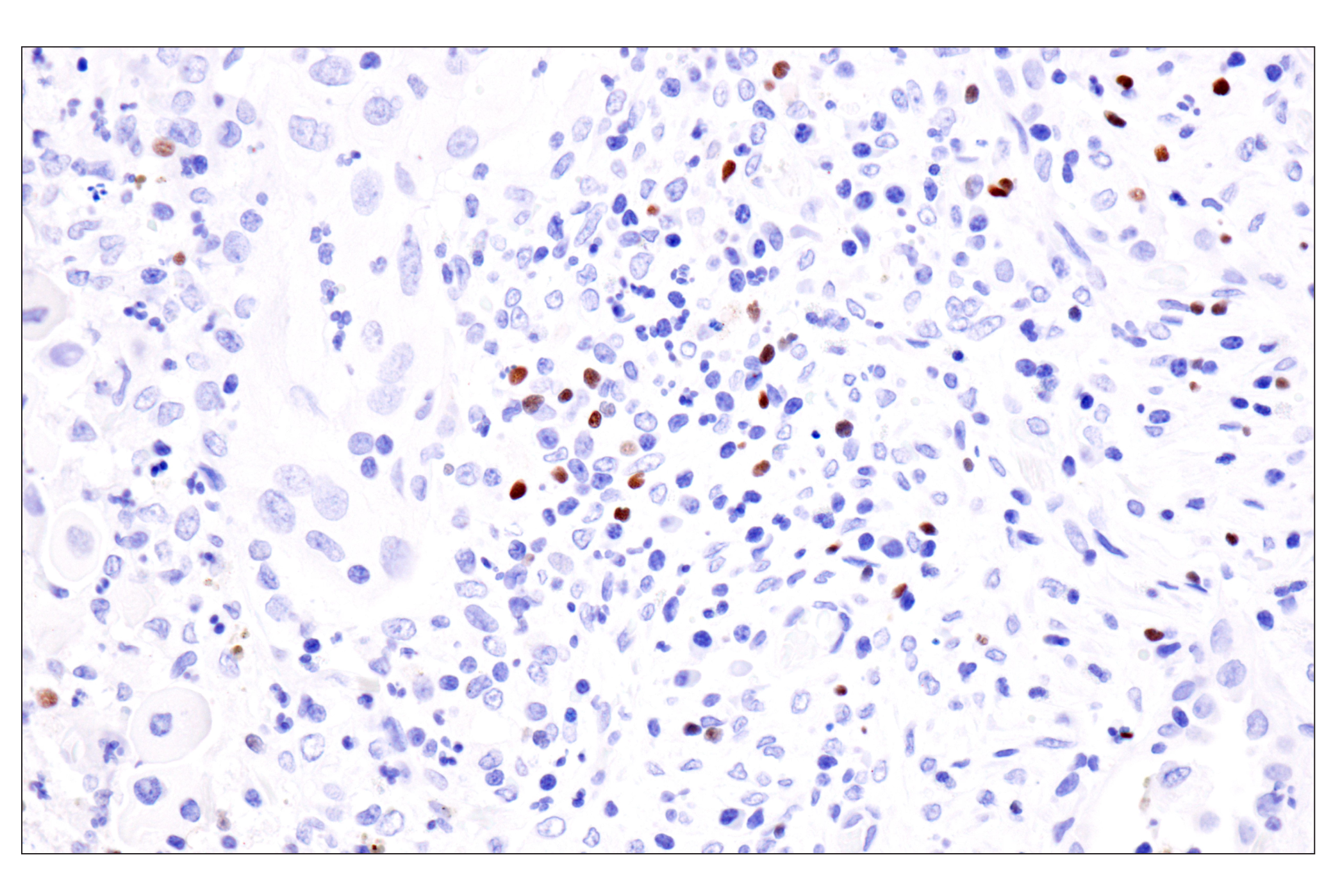 Immunohistochemistry Image 3: FoxP3 (221D) Mouse Monoclonal Antibody