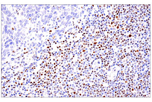 Immunohistochemistry Image 4: SATB1 (E5Z3U) Rabbit mAb