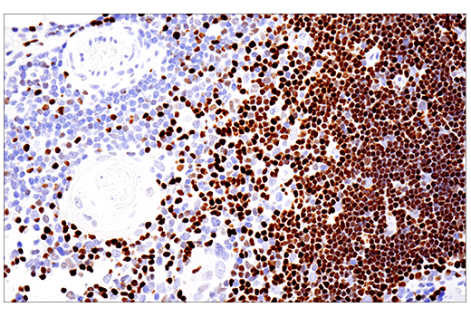 Immunohistochemistry Image 7: SATB1 (E5Z3U) Rabbit mAb