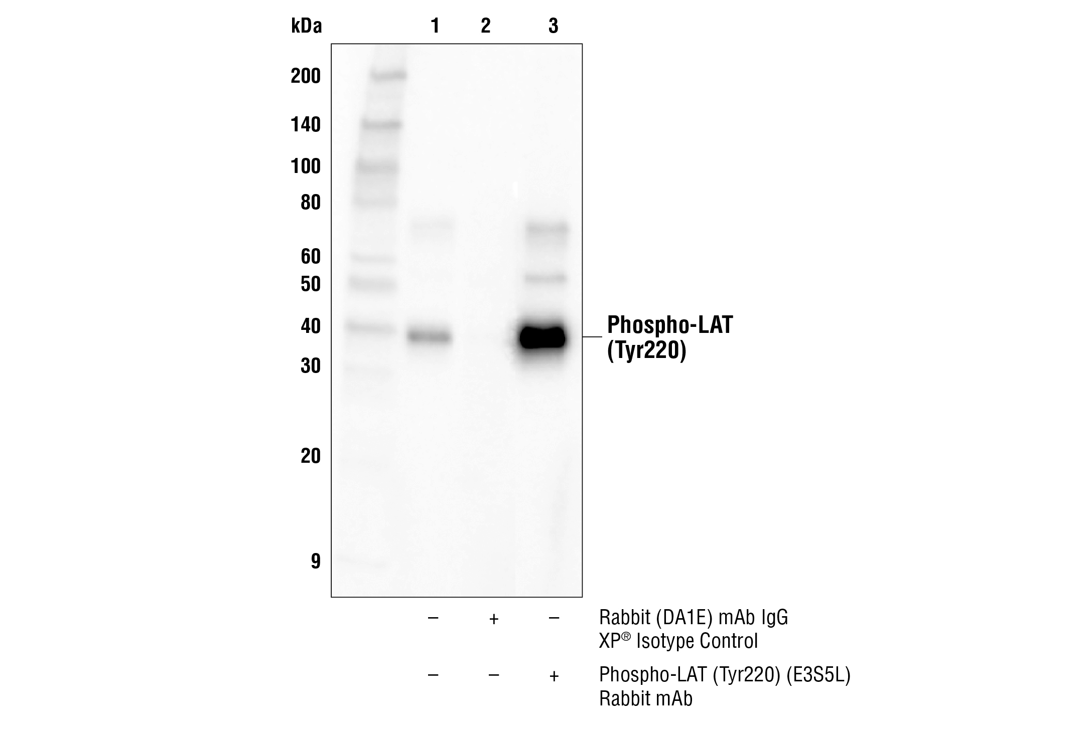 Immunoprecipitation Image 1: Phospho-LAT (Tyr220) (E3S5L) Rabbit mAb
