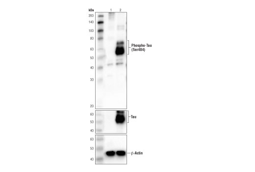  Image 15: Phospho-Tau Family Antibody Sampler Kit