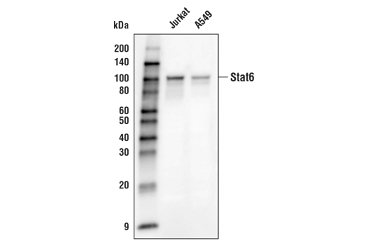 Western Blotting Image 1: Stat6 (D3H4) Rabbit mAb (Biotinylated)