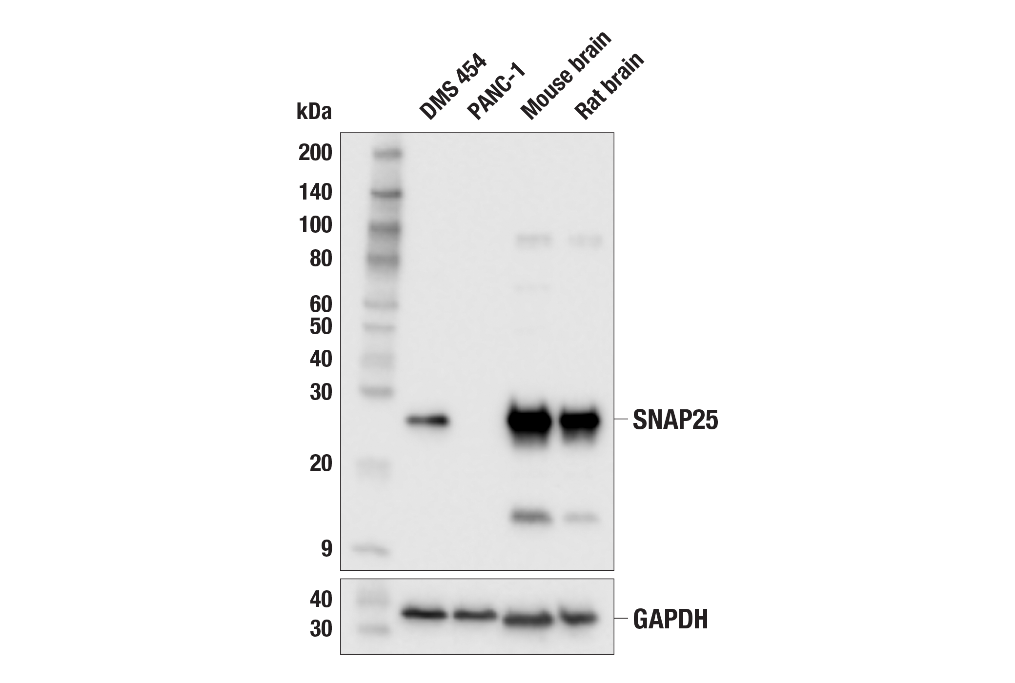 Western Blotting Image 1: SNAP25 (F1A9G) Mouse mAb