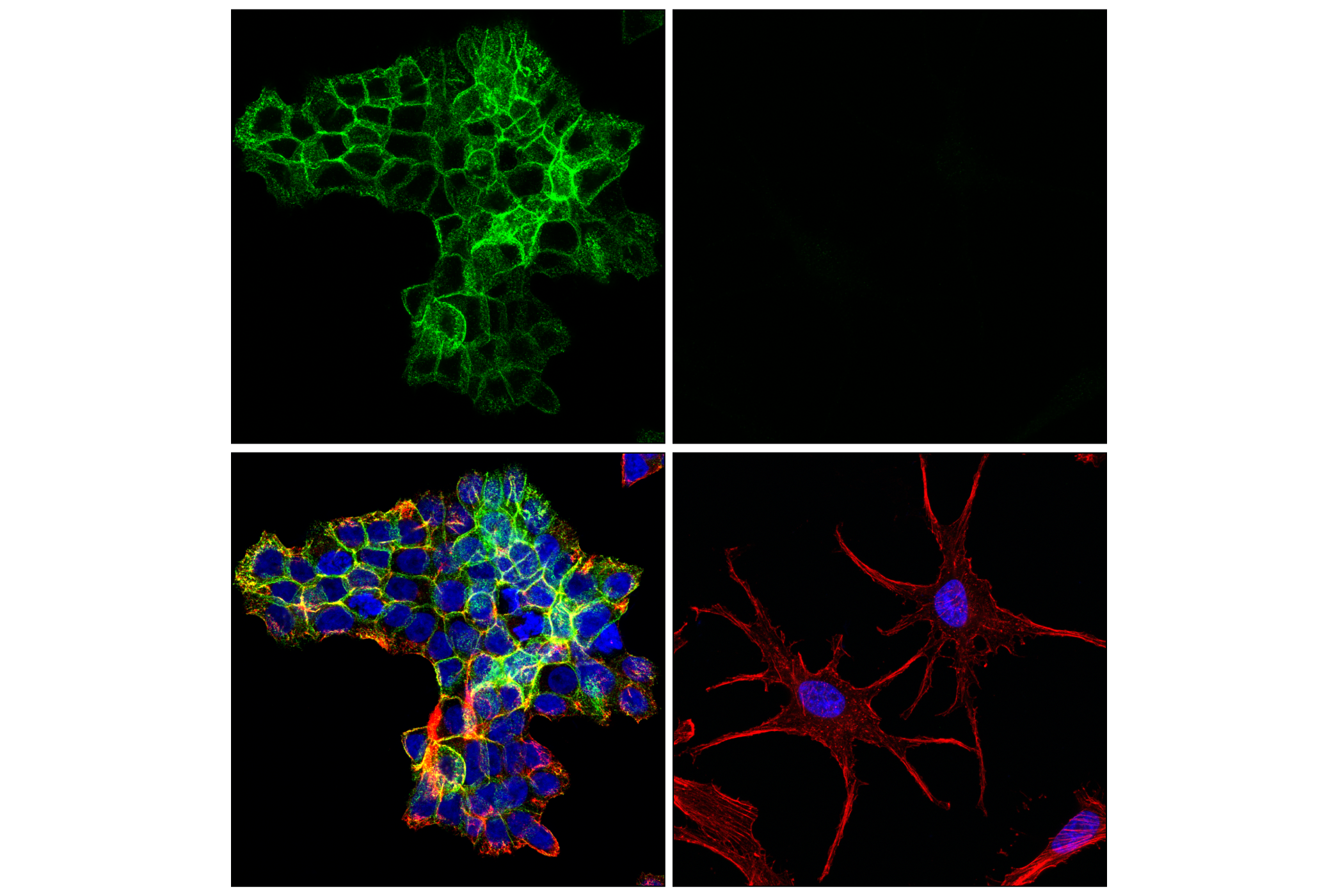 Immunofluorescence Image 4: SNAP25 (F1A9G) Mouse mAb