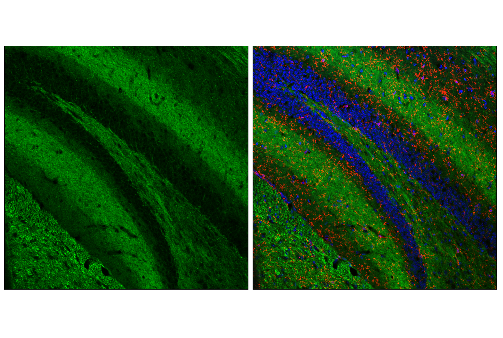 Immunofluorescence Image 1: SNAP25 (F1A9G) Mouse mAb