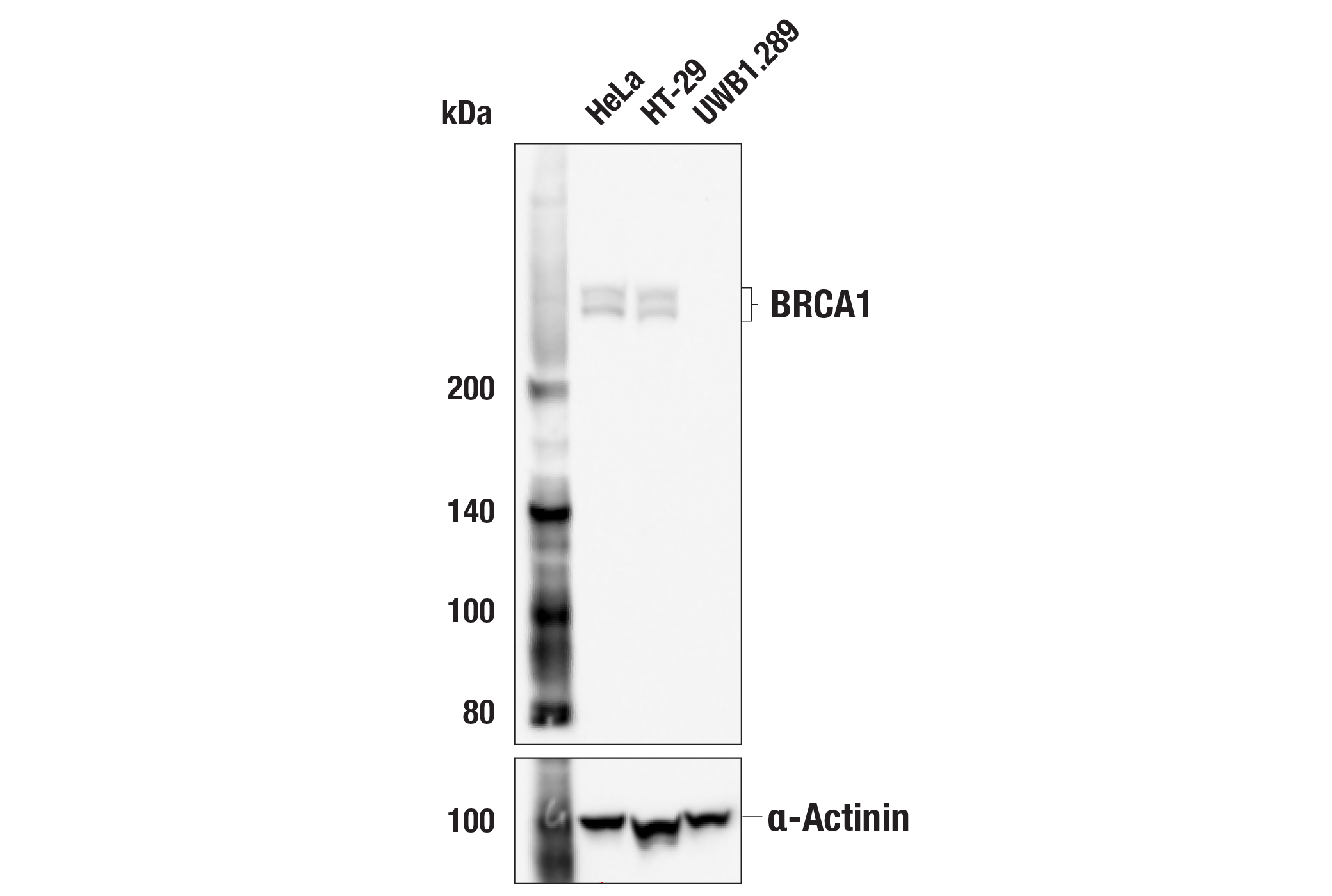 Western Blotting Image 1: BRCA1 (E5S9G) Rabbit mAb (BSA and Azide Free)
