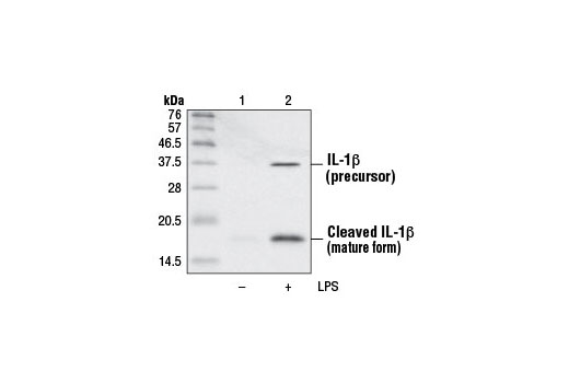 Western Blotting Image 1: IL-1β Antibody