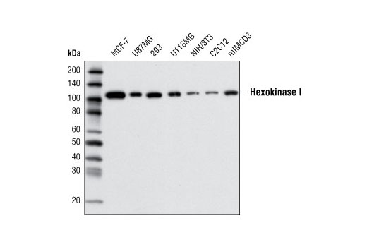 Western Blotting Image 1: Hexokinase I (C35C4) Rabbit mAb