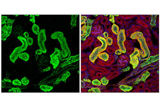 Immunofluorescence Image 3: Hexokinase I (C35C4) Rabbit mAb