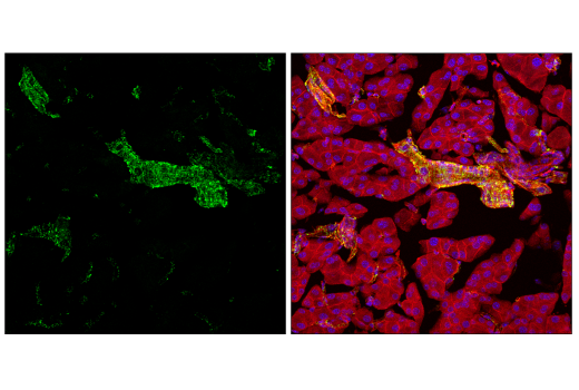 Immunofluorescence Image 2: Hexokinase I (C35C4) Rabbit mAb