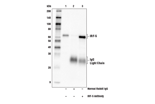  Image 16: IRF Family Antibody Sampler Kit