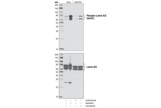 Western Blotting Image 1: Phospho-Lamin A/C (Ser22) Antibody