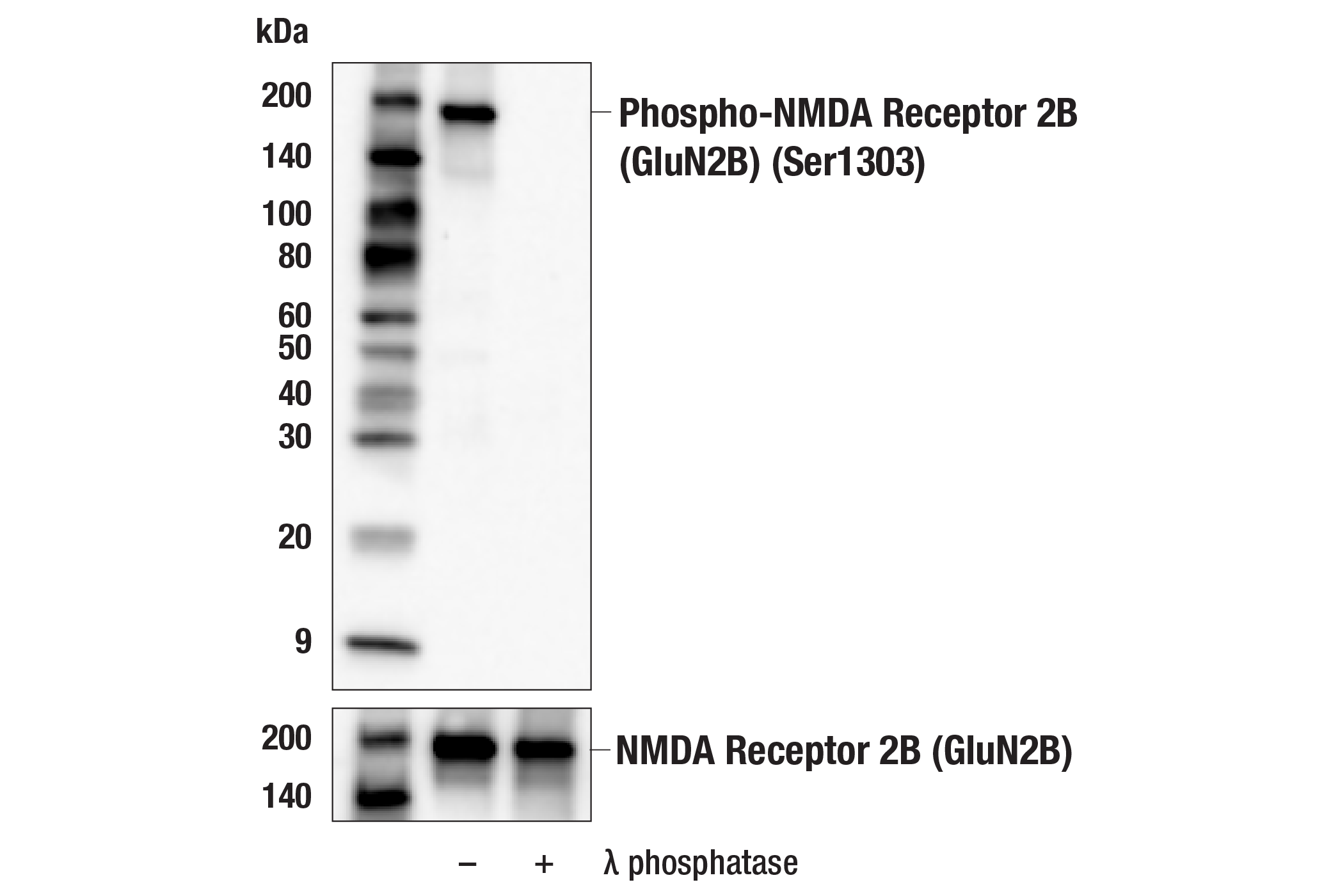 Western Blotting Image 1: Phospho-NMDA Receptor 2B (GluN2B) (Ser1303) (E3E9I) Rabbit mAb