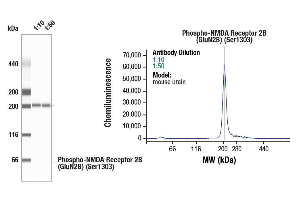 Western Blotting Image 2: Phospho-NMDA Receptor 2B (GluN2B) (Ser1303) (E3E9I) Rabbit mAb