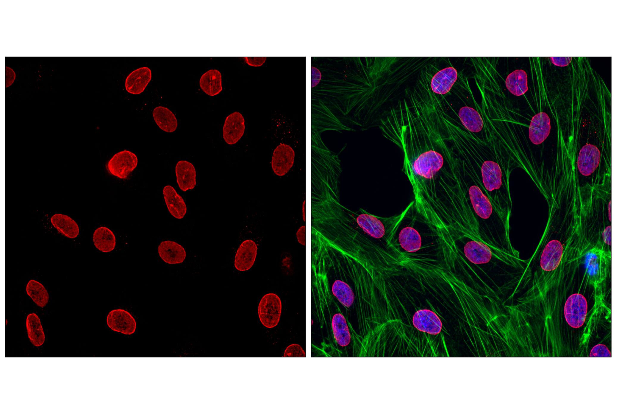 Immunofluorescence Image 1: NUP98 (C39A3) Rabbit mAb (Alexa Fluor® 555 Conjugate)