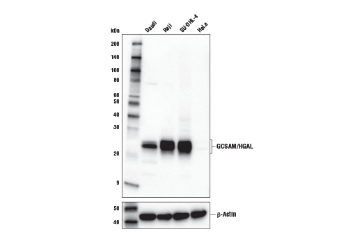 Western Blotting Image 1: GCSAM/HGAL Antibody