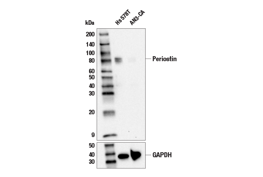 Western Blotting Image 1: Periostin (E5F2S) Rabbit mAb