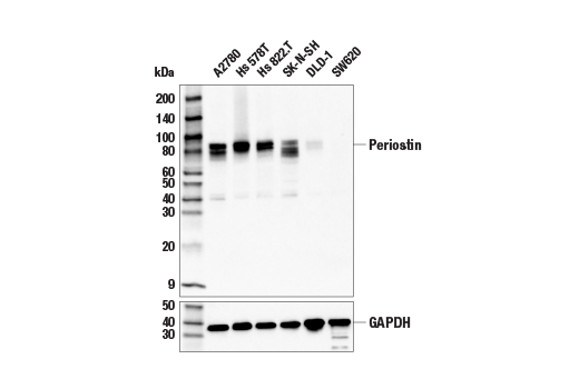 Western Blotting Image 2: Periostin (E5F2S) Rabbit mAb