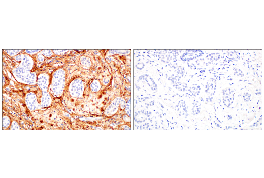 Immunohistochemistry Image 7: Periostin (E5F2S) Rabbit mAb