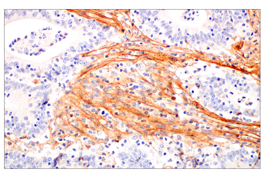 Immunohistochemistry Image 5: Periostin (E5F2S) Rabbit mAb