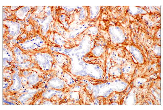 Immunohistochemistry Image 1: Periostin (E5F2S) Rabbit mAb