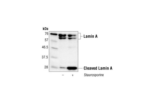Western Blotting Image 2: Lamin A/C Antibody