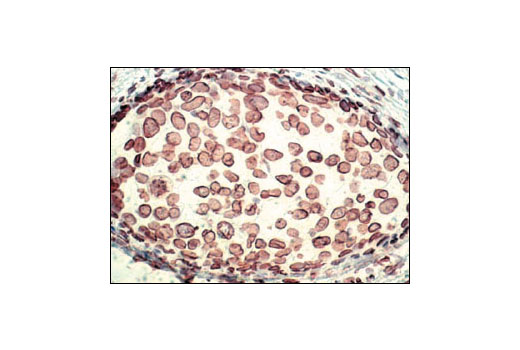 Immunohistochemistry Image 1: Lamin A/C Antibody