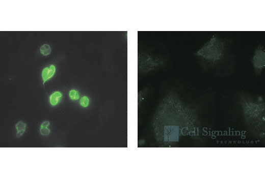 Immunofluorescence Image 1: Cleaved Lamin A (Small Subunit) (30H5) Mouse mAb