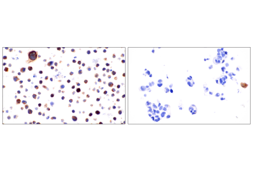 Immunohistochemistry Image 7: LC3B (E5Q2K) Mouse mAb (BSA and Azide Free)