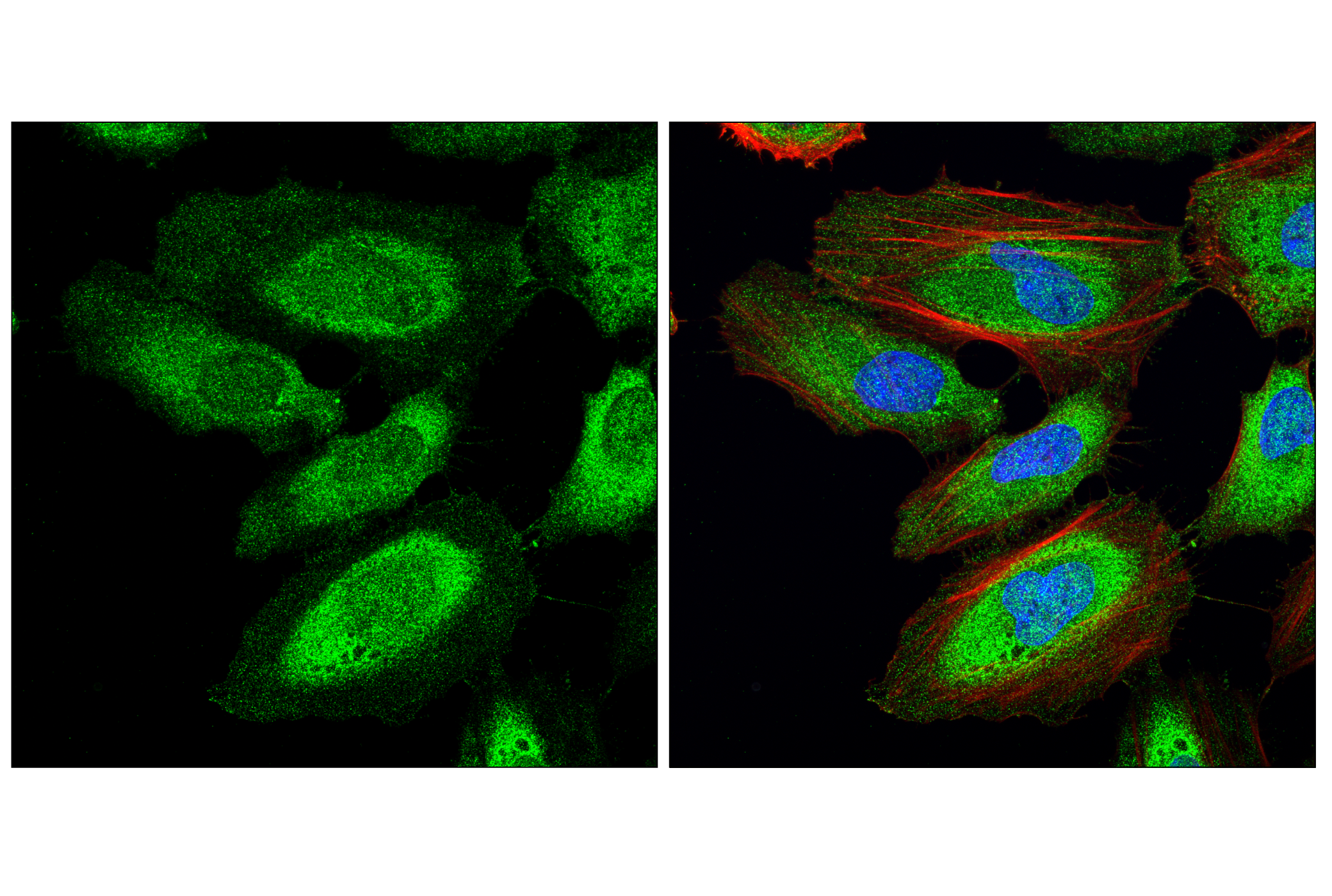 Immunofluorescence Image 1: PP2A C Subunit Antibody