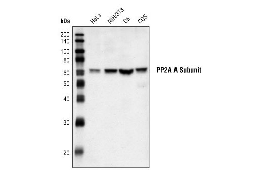 Western Blotting Image 1: PP2A A Subunit Antibody