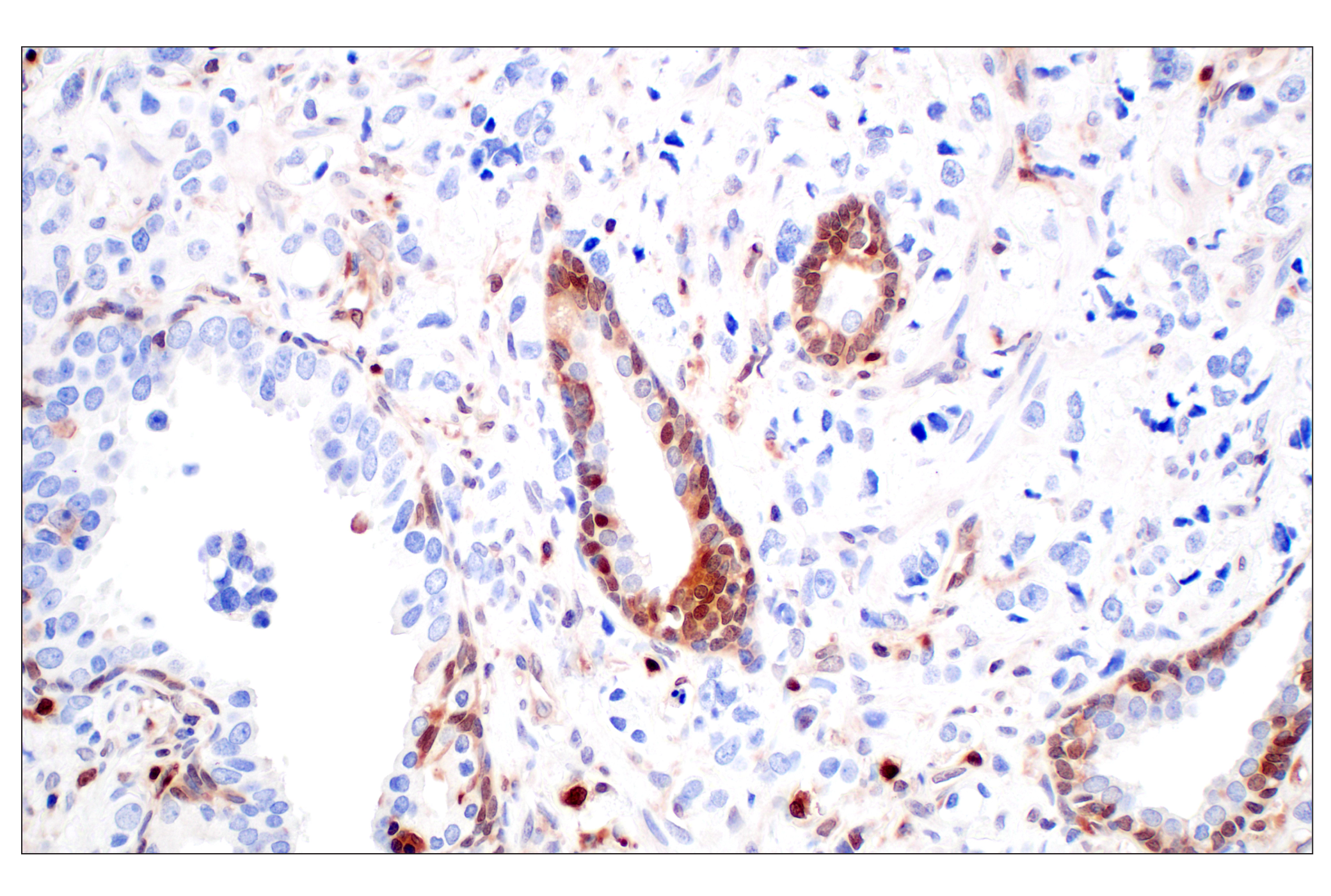 Immunohistochemistry Image 3: SerpinB1 (E4W7B) Rabbit mAb