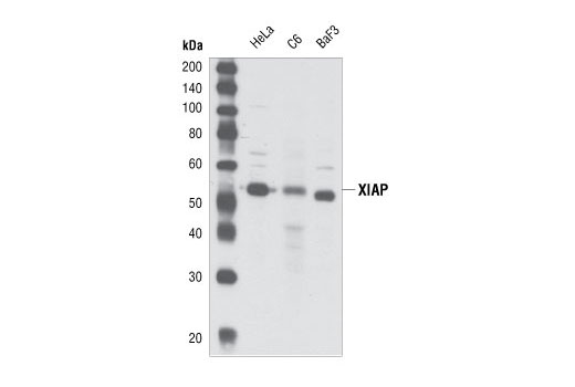Western Blotting Image 1: XIAP Antibody