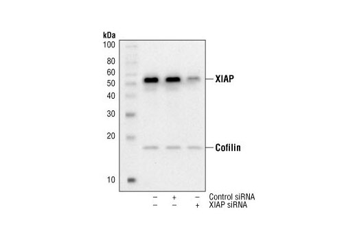 Western Blotting Image 2: XIAP Antibody