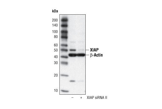 Western Blotting Image 3: XIAP Antibody